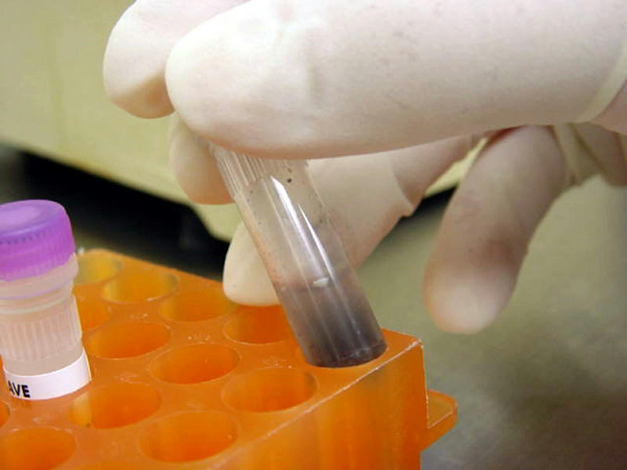 (NNS11-NOV21) A molecular microbiologist with the Michigan health department prepares to check a sample for the presence of West Nile virus. SEE ``WESTNILE-BLOOD'' (Newhouse), transmitted Nov. 21. (Photo courtesy of the Michigan Department of Community Health)
