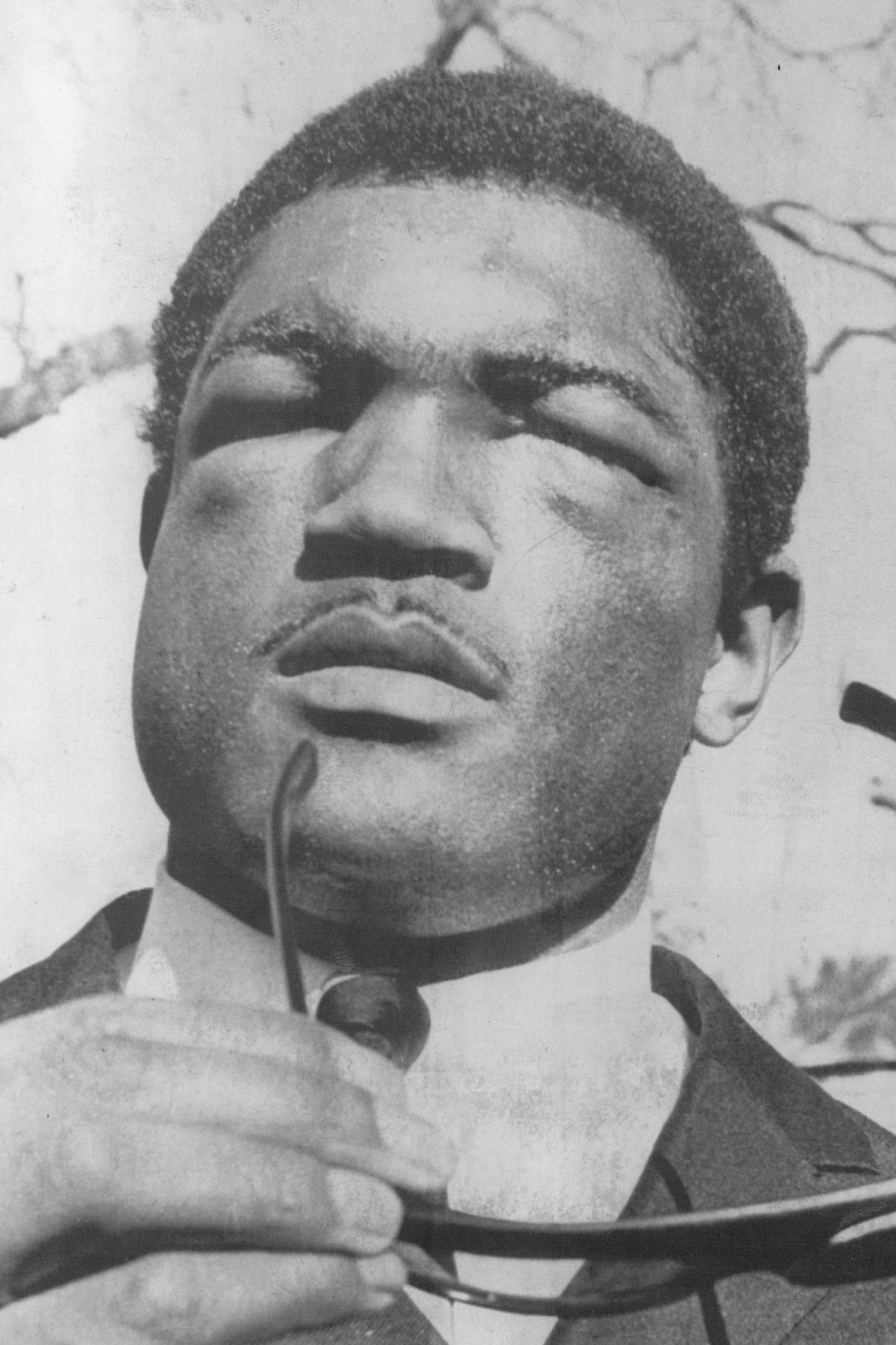 February 8, 1967 Ernie Terrell displayed badly swollen eyes Result of fight with champion Cassius Clay Monday February 7, 1967 Associated Press
