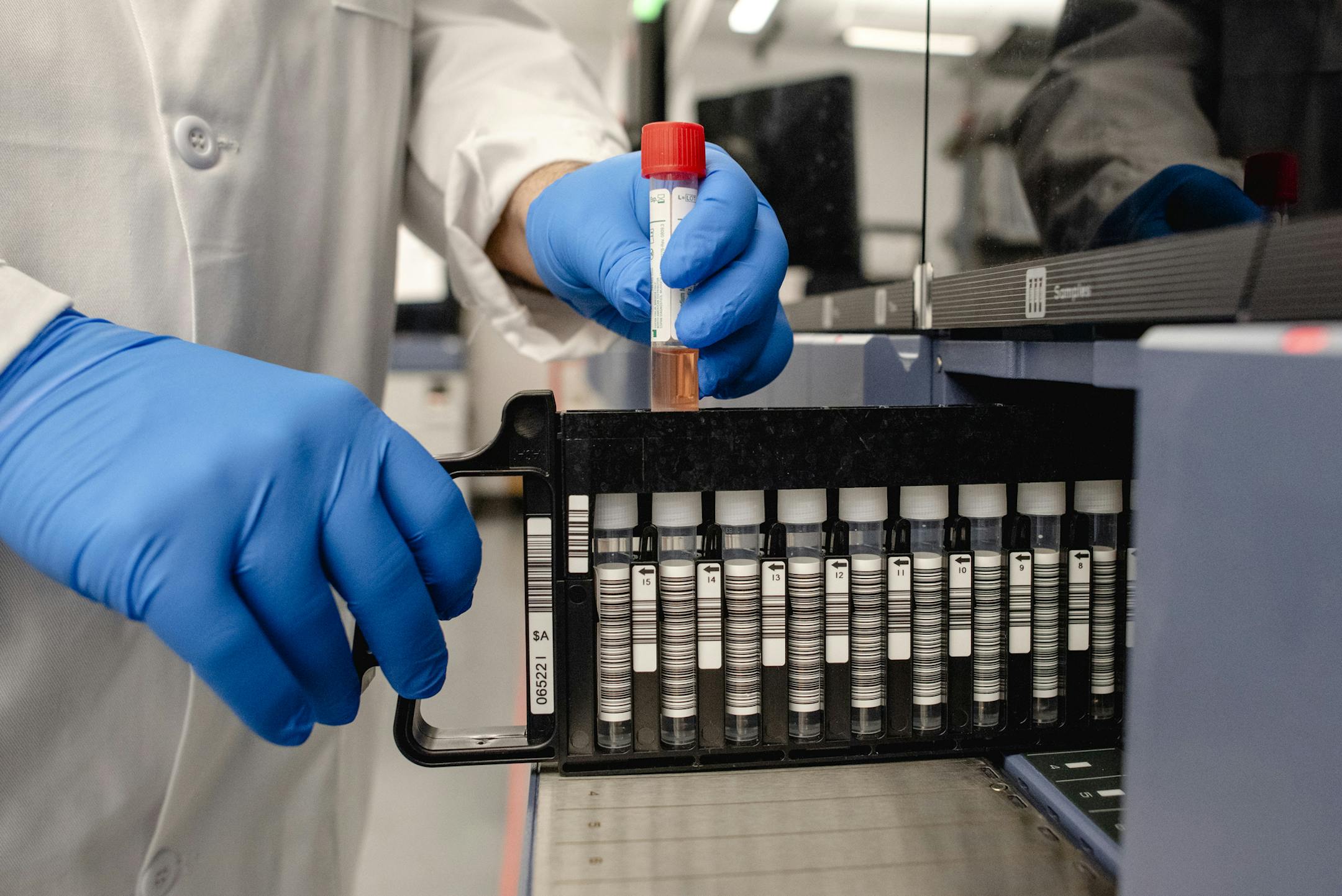 Dr. Dwayne Breining, executive director of the Northwell Health Laboratories, demonstrates a coronavirus test processing procedure in Lake Success, N.Y., on Wednesday, March 4, 2020.