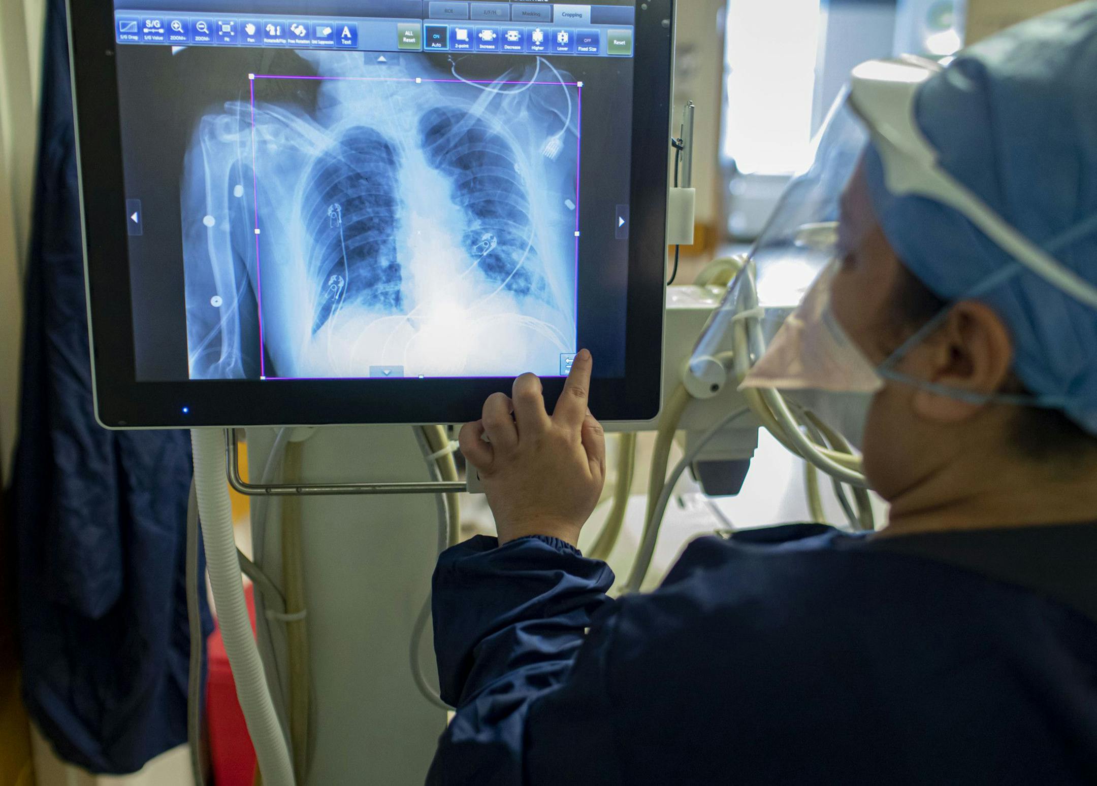Arlene Ramirez, an MRI technologist, reviews a chest X-ray from a COVID-19 patient in the ICU on May 11, 2020, at St. Anthony Hospital in Chicago. (Brian Cassella/Chicago Tribune/TNS) ORG XMIT: 3596229W