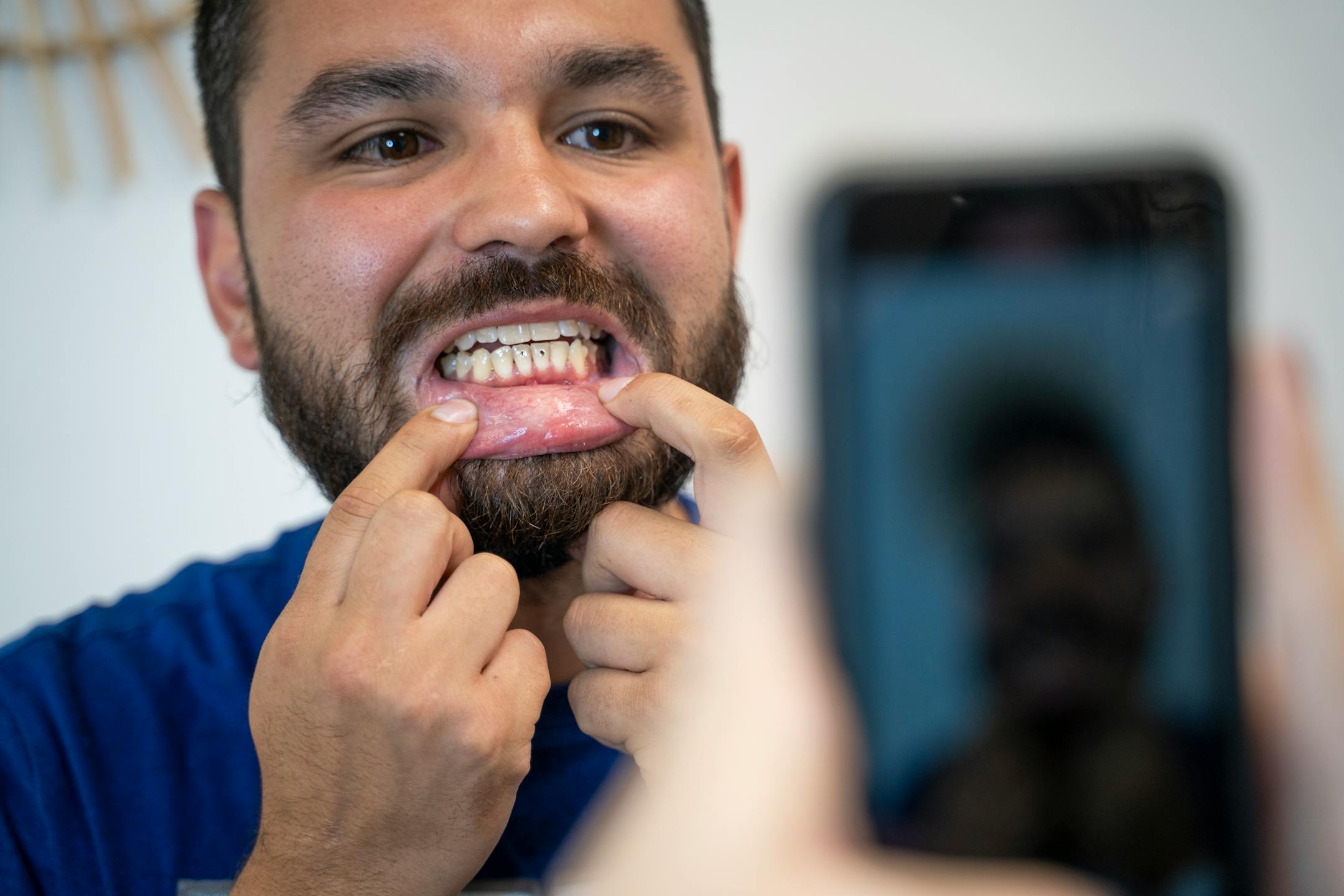 Andrew Montez shows off his newly gemmed teeth for a TikTok at Pearly Whites MN in Burnsville, Minn. on Thursday, June 29, 2023.