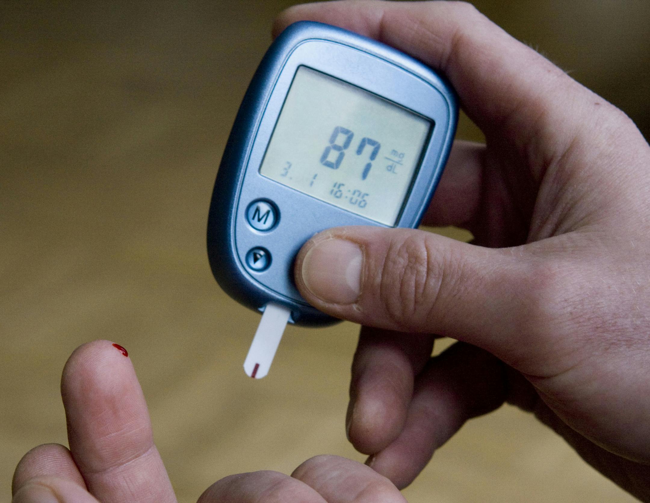 FILE - This Jan. 3, 2009 file photo shows a person with diabetes testing his blood sugar level in Kamen, Germany. New research published in the Thursday, Aug. 8, 2013 New England Journal of Medicine suggests a possible way to help prevent Alzheimer's disease: Keeping blood sugar at a healthy level. A study found that higher glucose levels, even those well short of diabetes, seemed to raise the risk for dementia. (AP Photo/Joerg Sarbach, File)