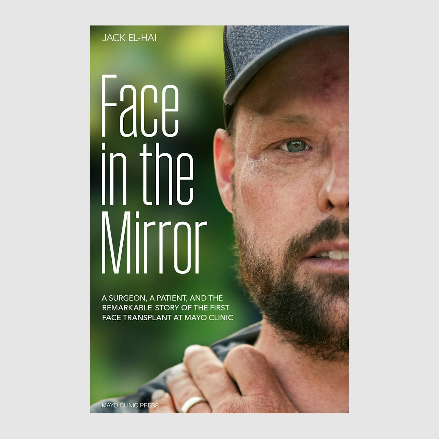 cover of Face in the Mirror features a photo of face transplant recipient Andy Sandness
