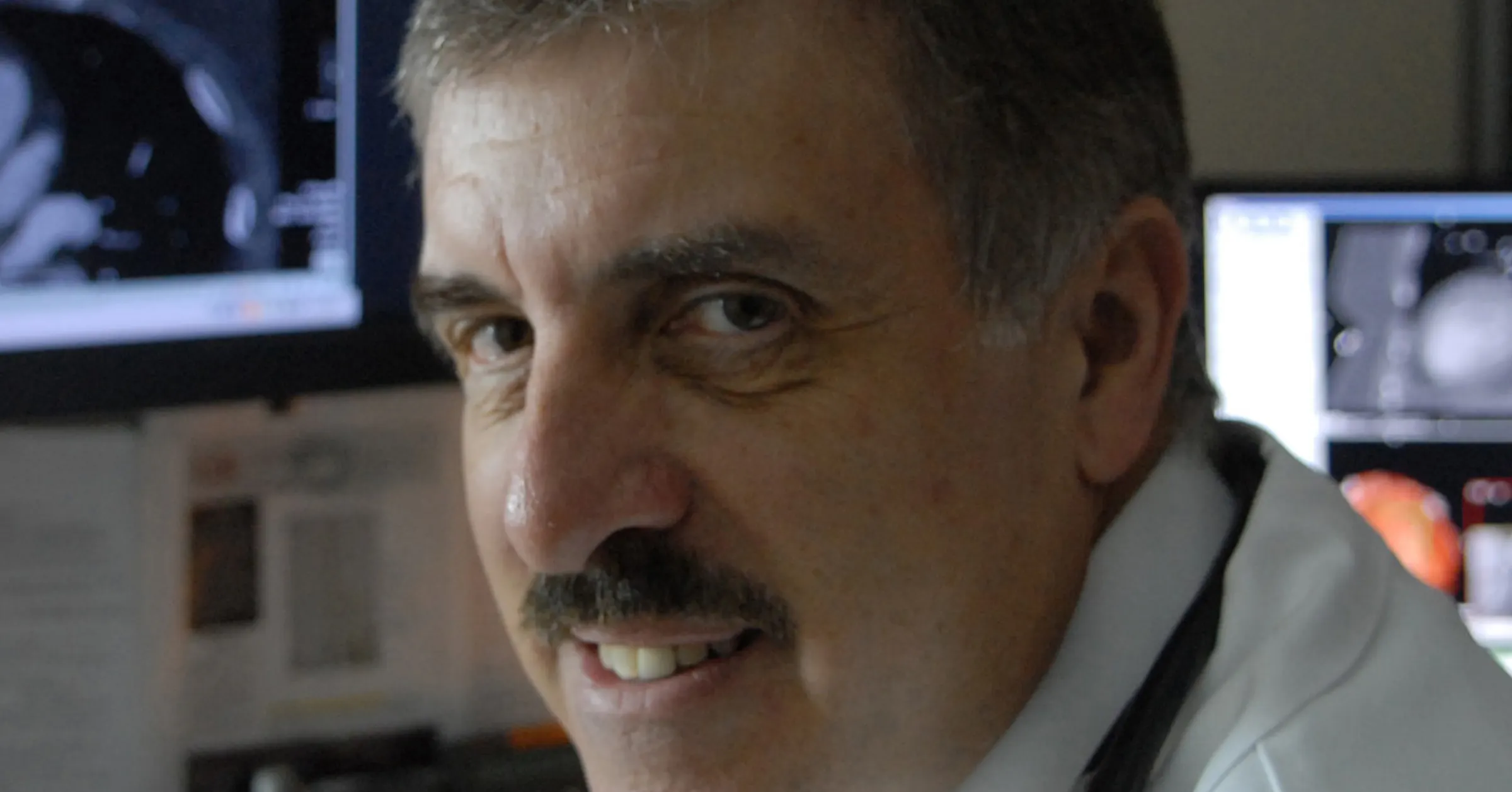 Professor Anthony Rudd New research showing possible causes of stroke after heart procedures