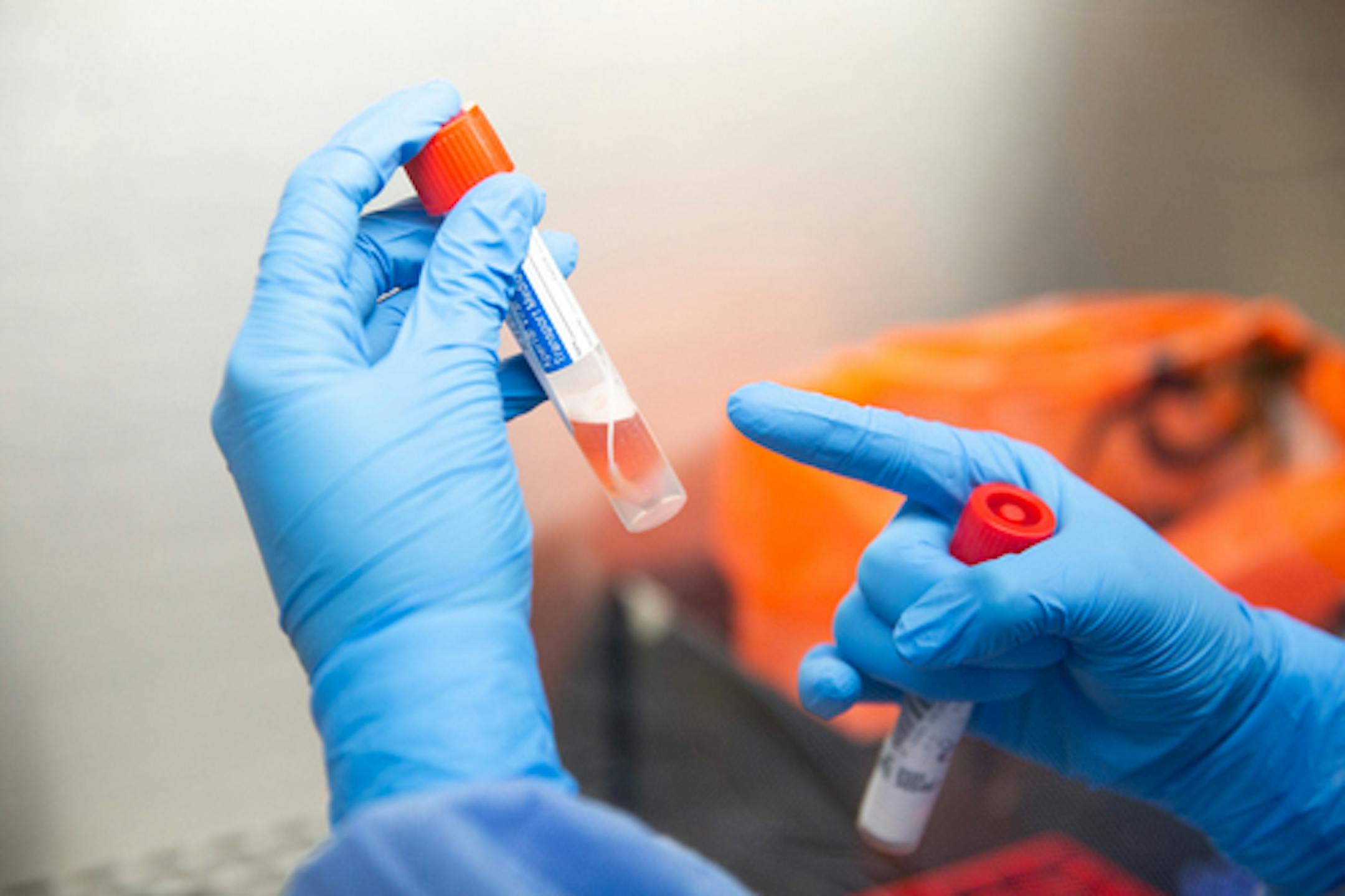 Vials of COVID-19 samples were tested on Tuesday, March 3, 2020.