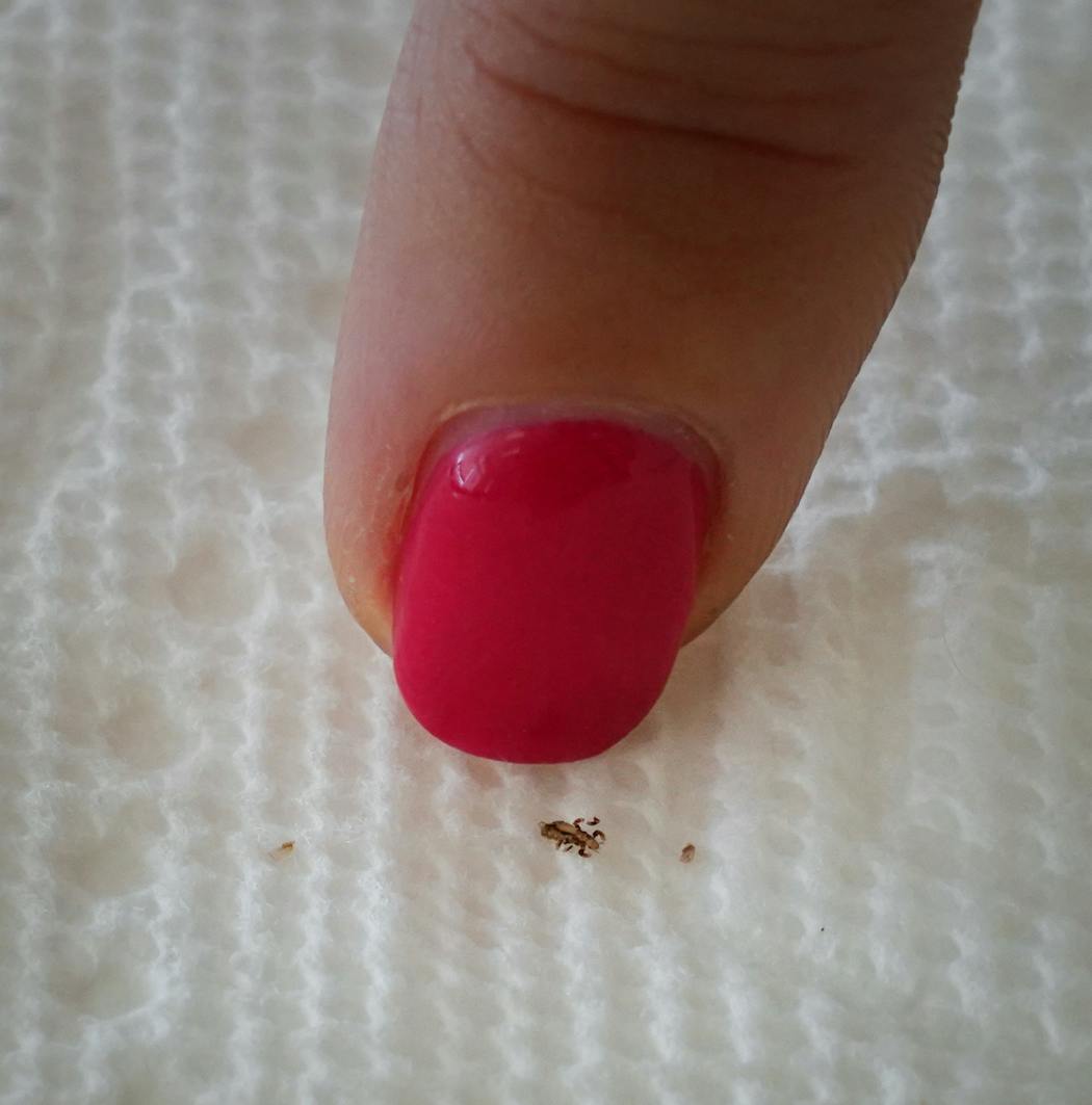 In this photo from 2019, Ladibugs co-founder Lisa Rudquist pointed out a louse and nits that were removed from a client.