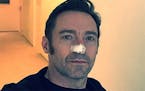 Hugh Jackman posted a photo on Instagram after a recent round of cancer treatment.
