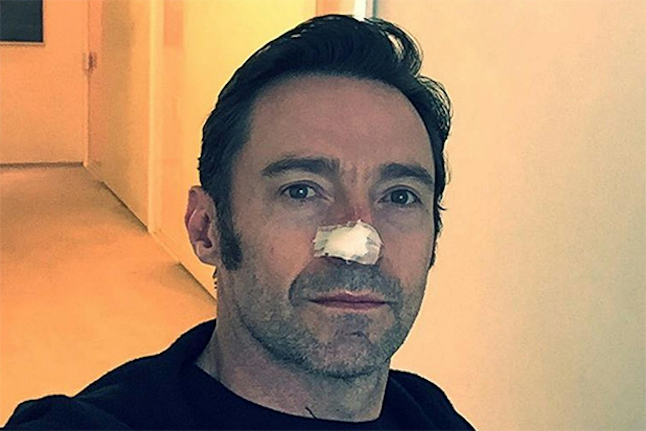 Hugh Jackman posted a photo on Instagram after a recent round of cancer treatment.
