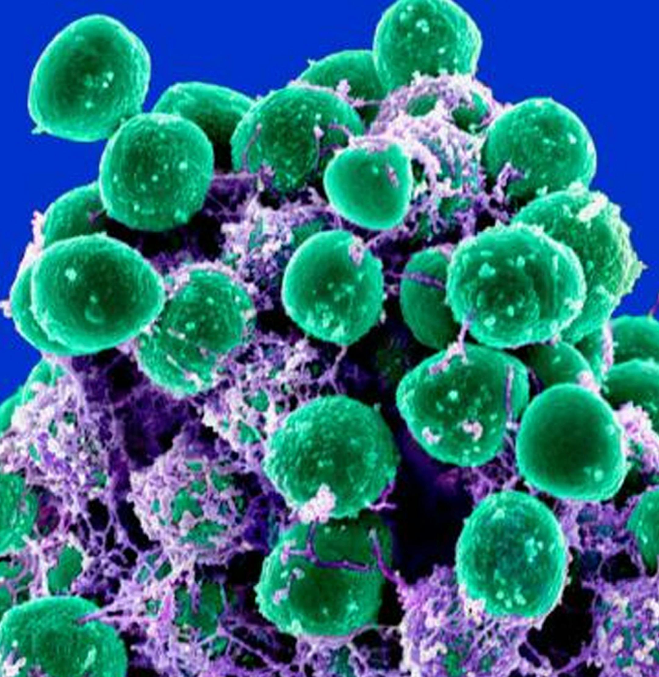 At left, undated handout image provided by the National Institute of Allergy and Infectious Diseases (NIAID) shows a clump of Staphylococcus epidermidis bacteria (green) in the extracellular matrix, which connects cells and tissue, taken with a scanning electron microscope, showing. At right, undated handout image provided by the Agriculture Department showing the bacterium, Enterococcus faecalis, which lives in the human gut, is just one type of microbe that will be studied as part of NIH's Hum