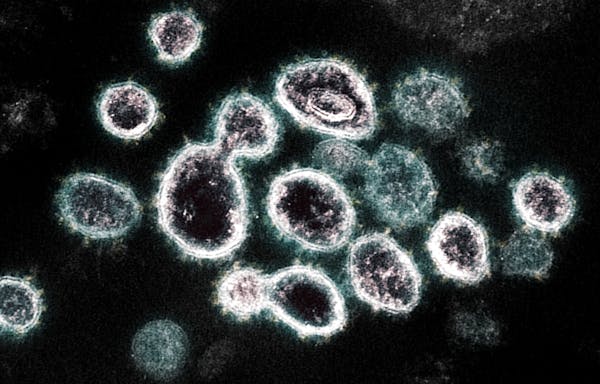 An electron microscope image shows SARS-CoV-2, the virus that causes COVID-19, isolated from a patient in the U.S.