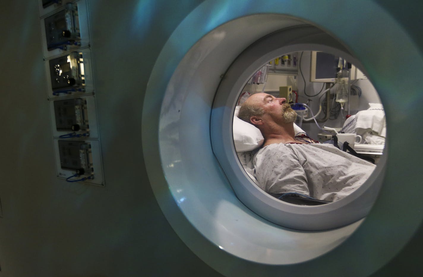 Terry Begnoche laid in a hyperbolic chamber at HCMC in Minneapolis, Minn., on Friday, September 26, 2014, after a diving incident in Lake Superior that almost killed him. ] RENEE JONES SCHNEIDER &#x2022; reneejones@startribune.com