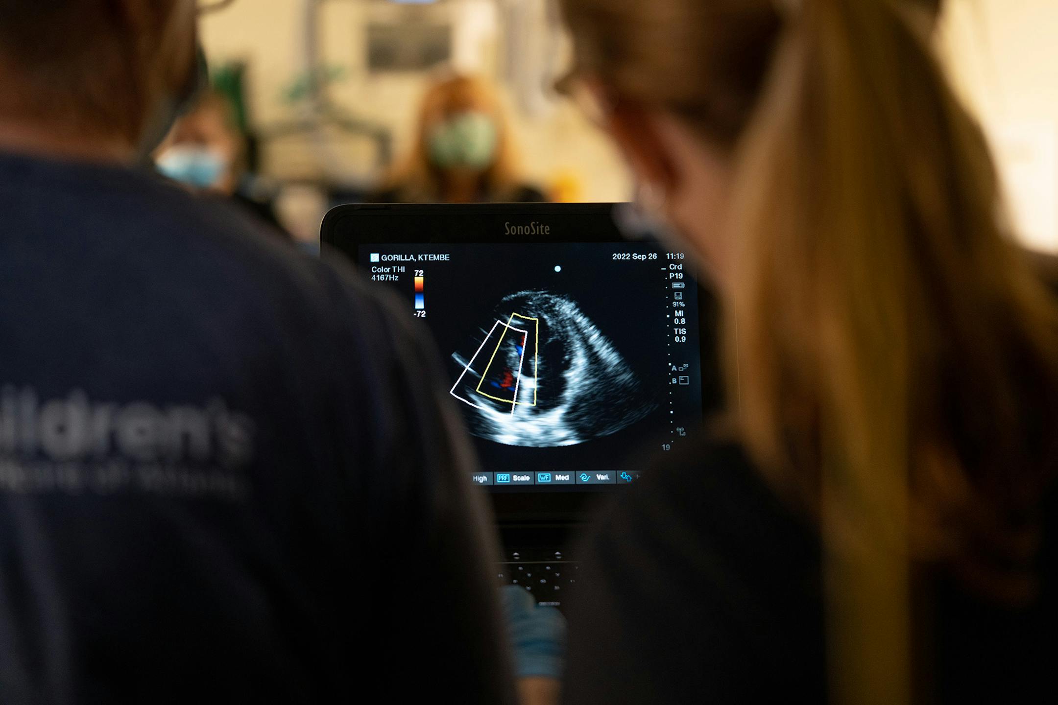 Shown is data from a Medtronic heart monitor in Ktembe, a gorilla who lives at the Columbus (Ohio) Zoo and Aquarium