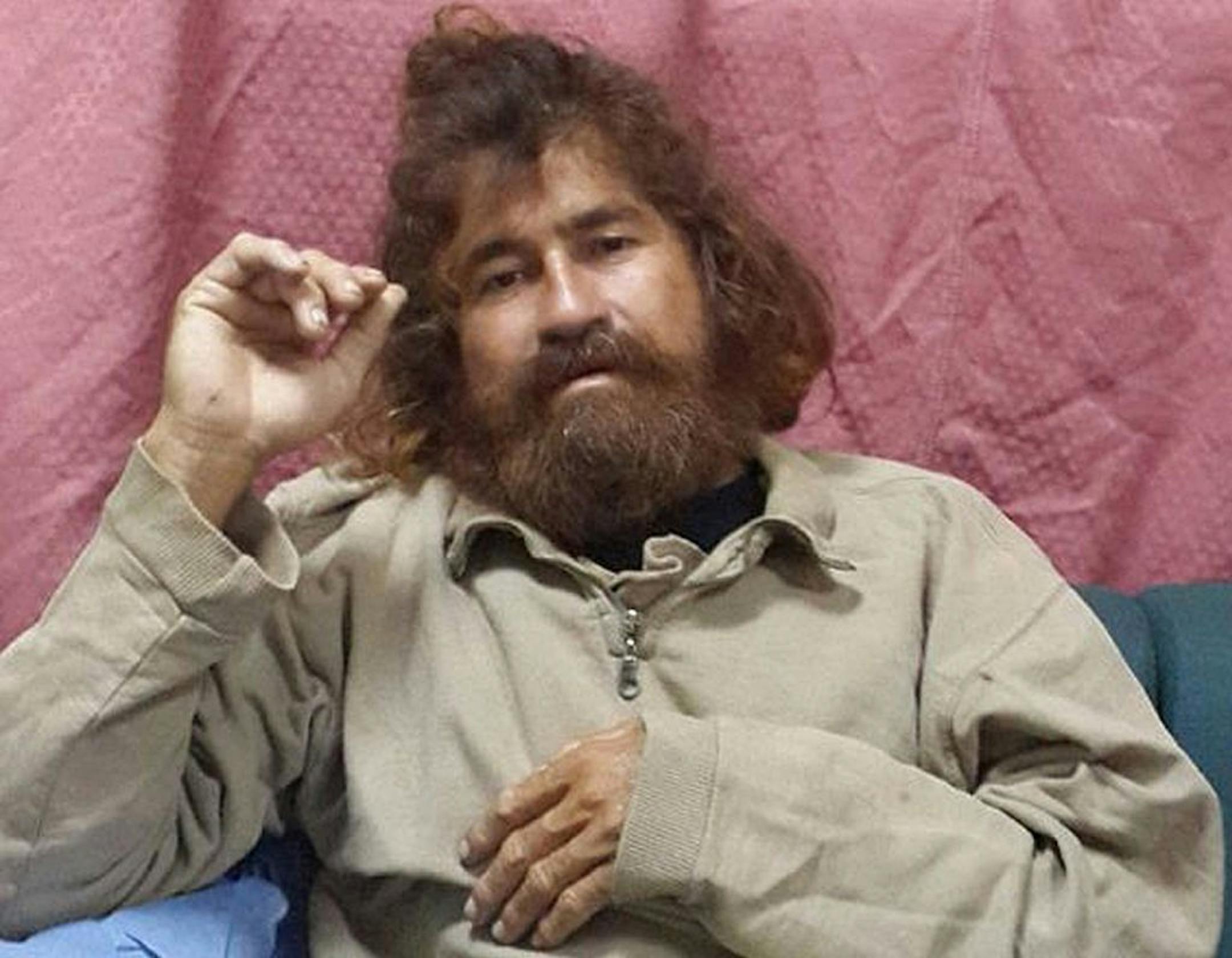 In this Monday, Feb. 3, 2014 photo provided by the Marshall Islands Foreign Affairs Department, a man identifying himself as 37-year-old Jose Salvador Alvarenga sits on a couch in Majuro in the Marshall Islands, after he was rescued from being washed ashore on the tiny atoll of Ebon in the Pacific Ocean.