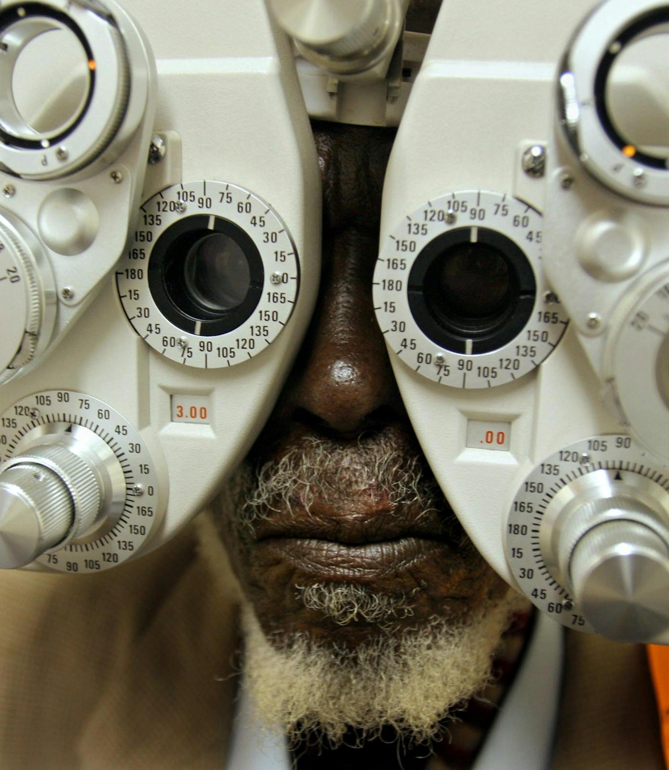 June Spogter, has his eyes tested for lenses to be made for a new pair of glasses inside the Phelophepa train, at the rural Kirkwood railway station, South Africa, Jan. 24, 2006. The train, meaning Good Clean Health, is equipped with a full contingent of volunteer doctors, dentists, optometrists, psychologists and health educators on board, to deliver affordable primary health care to deprived rural communities in South Afrca. Spogter was for intent intent purposes blind as a post and has been f
