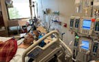 Truck driver Joe Gammon has been receiving ECMO therapy at Ascension Saint Thomas Hospital in Nashville, Tennessee, since mid-August, allowing his blo