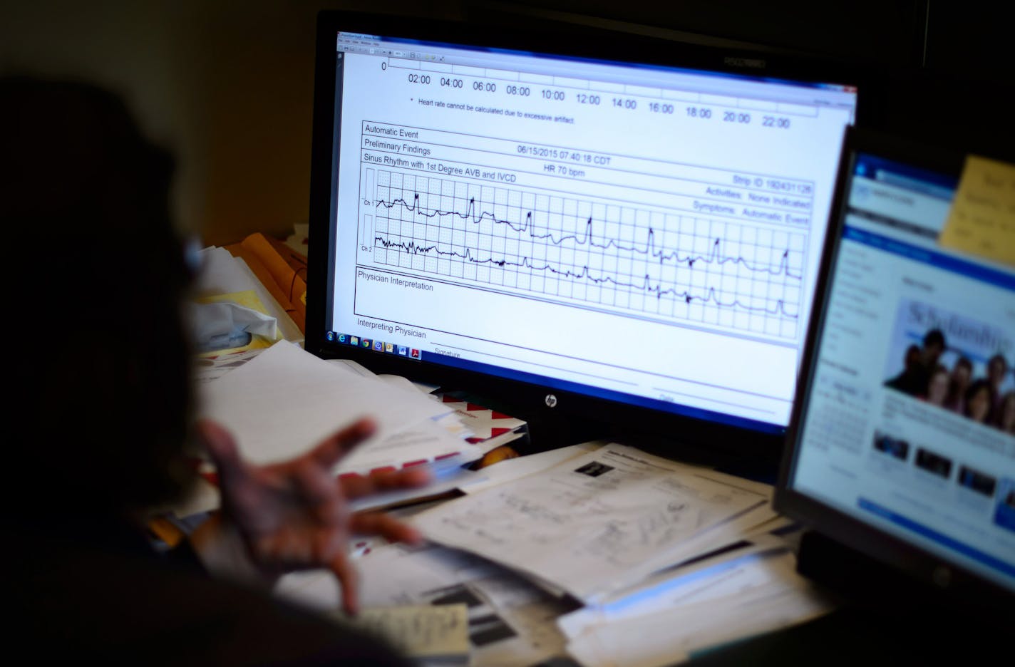 Home monitoring patient Jesse Todd is monitored by Mayo's remote monitoring unit where the staff monitors, blood pressure, blood sugar and movement of patients remotely. This is a display of her heart activity. ] GLEN STUBBE * gstubbe@startribune.com Tuesday, June 16, 2015 In one room at the Mayo Clinic, doctors watch TV-like screens to direct the care of patients in intensive care units hundreds of miles away. In another room, the staff monitors the blood pressure, blood sugar and movement of o