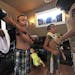 Jeff Leider, far left, shows Jason's, 8, scar from his most recent surgery as Deena Ledier, right, puts Justin's, 6, shirt back on after showing the I