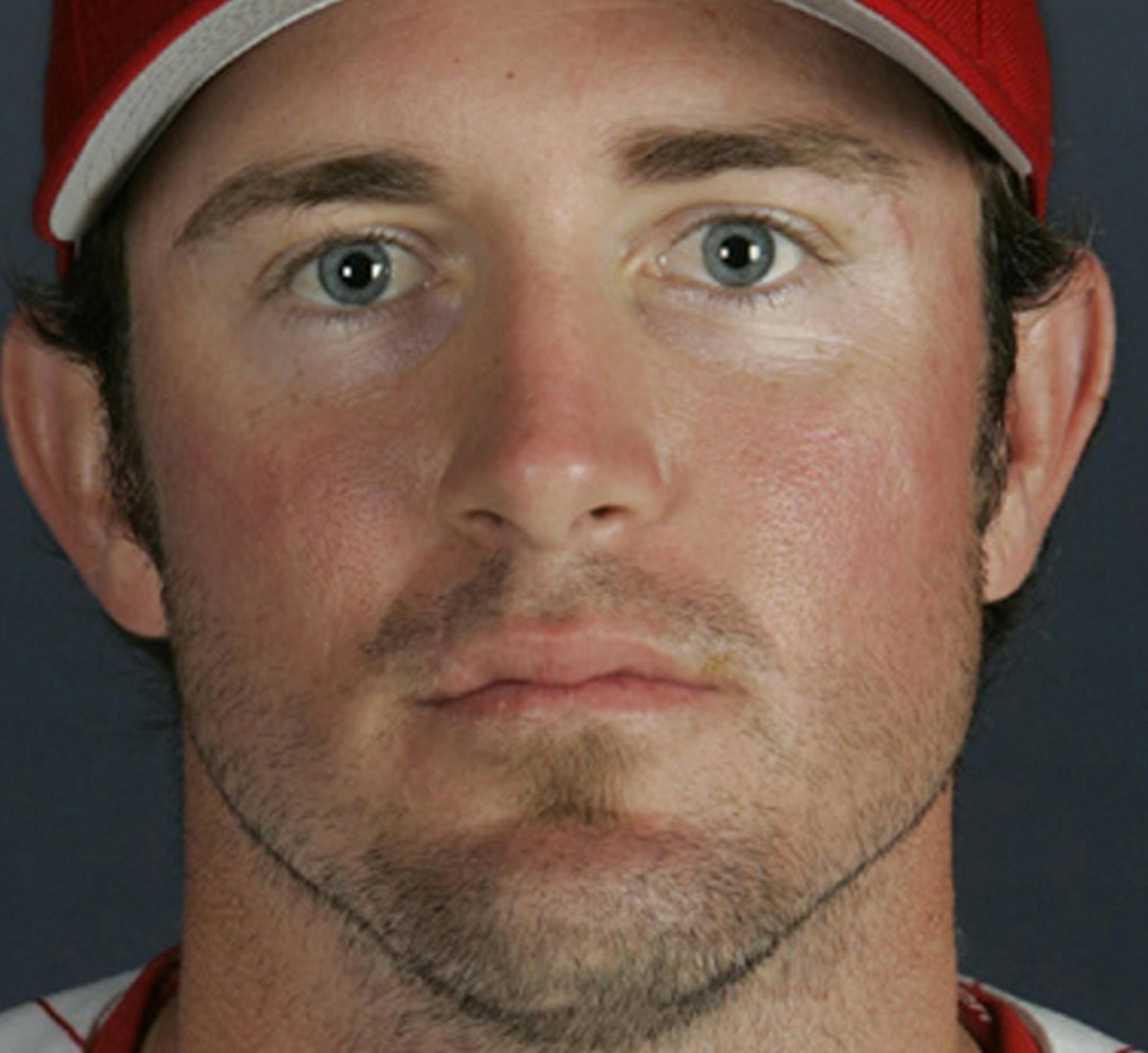 ** FILE ** Philadelphia Phillies' All-Star second baseman Chase Utley is shown in a March, 2006 file photo. Phillies All-Star second baseman Chase Utley had surgery on his right hand Friday and could miss a month of the season a day after his hand was broken when he was hit by a pitch. (AP Photo/Rusty Kennedy) ORG XMIT: NY164