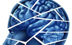 A new study shows mild traumatic brain injuries can have serious consequences for military veterans by raising their risk of dementia. (Dreamstime/TNS