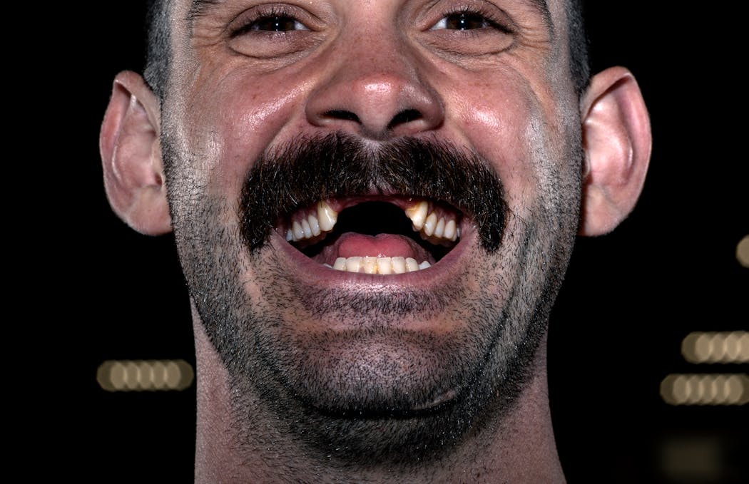 Jake Middleton’s hockey look includes a few missing teeth.