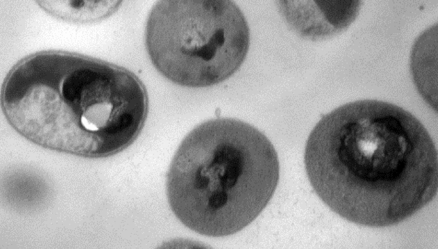 Cells of the Acinetobacter baumannii bacteria after
treatment with the polymers. Image shows the cytoplasmic substances within the bacterial cell membrane have precipitated, killing the bacteria. (Institute of Bioengineering and Nanotechnology) ORG XMIT: 1226299