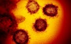 An image from an electron microscope shows SARS-CoV-2, the virus that causes COVID-19.
