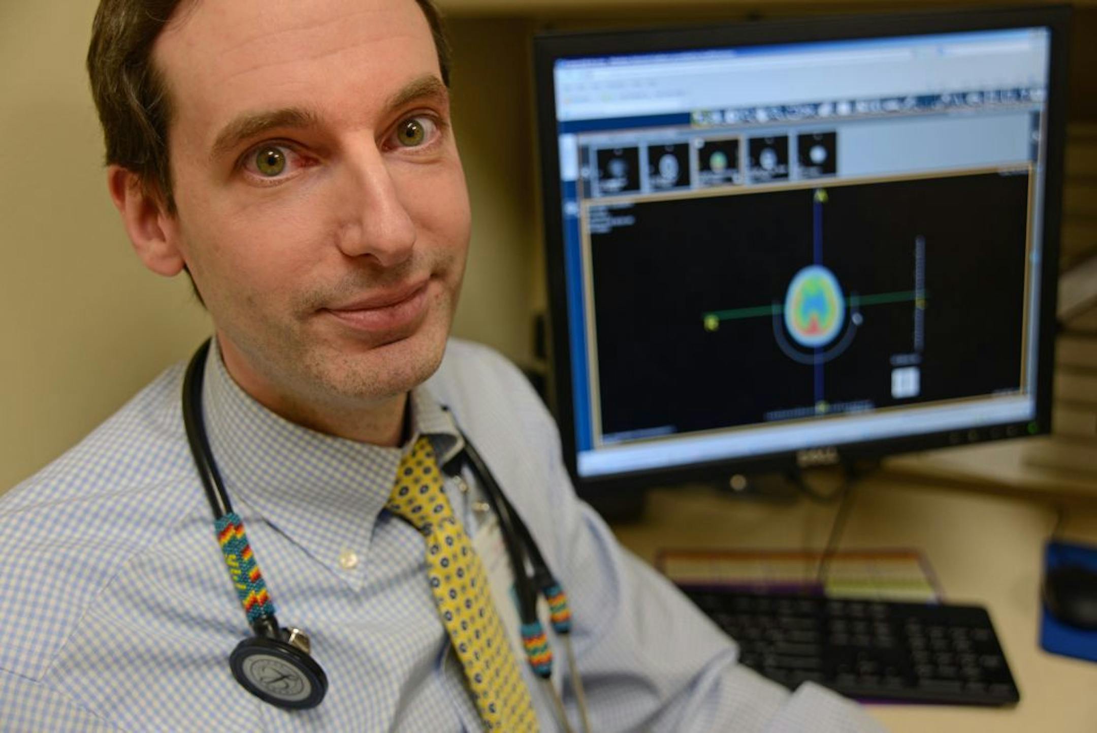 Some 1,300 people will head to the Rivercentre in St. Paul next Saturday to learn more about the millions of people suffering from dementia and Alzheimer's disease -- but the keynote address will be delivered on what some call "the most common disease no one has ever heard of," a brain wasting disease that typically strikes people in their prime. Dr. Michael Rosenbloom health partners neurologist looked over a PET scan of a patient suffering from frontotemporal dementia.