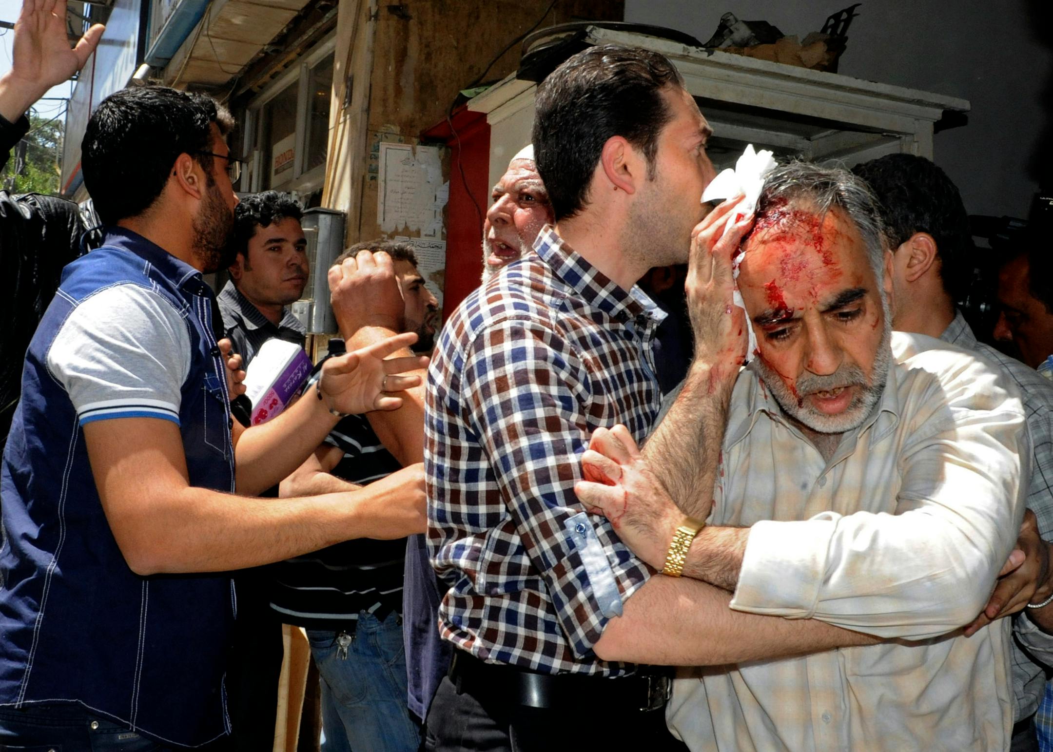 A Syrian man injured in a powerful explosion in Damascus, Syria on April 30.