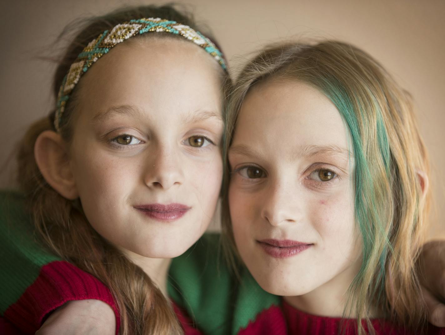 The success of Isabelle, left, and Abby has delighted and surprised their family and their doctors. The twins were born on Nov. 29, 2005, and were separated on May 12, 2006.