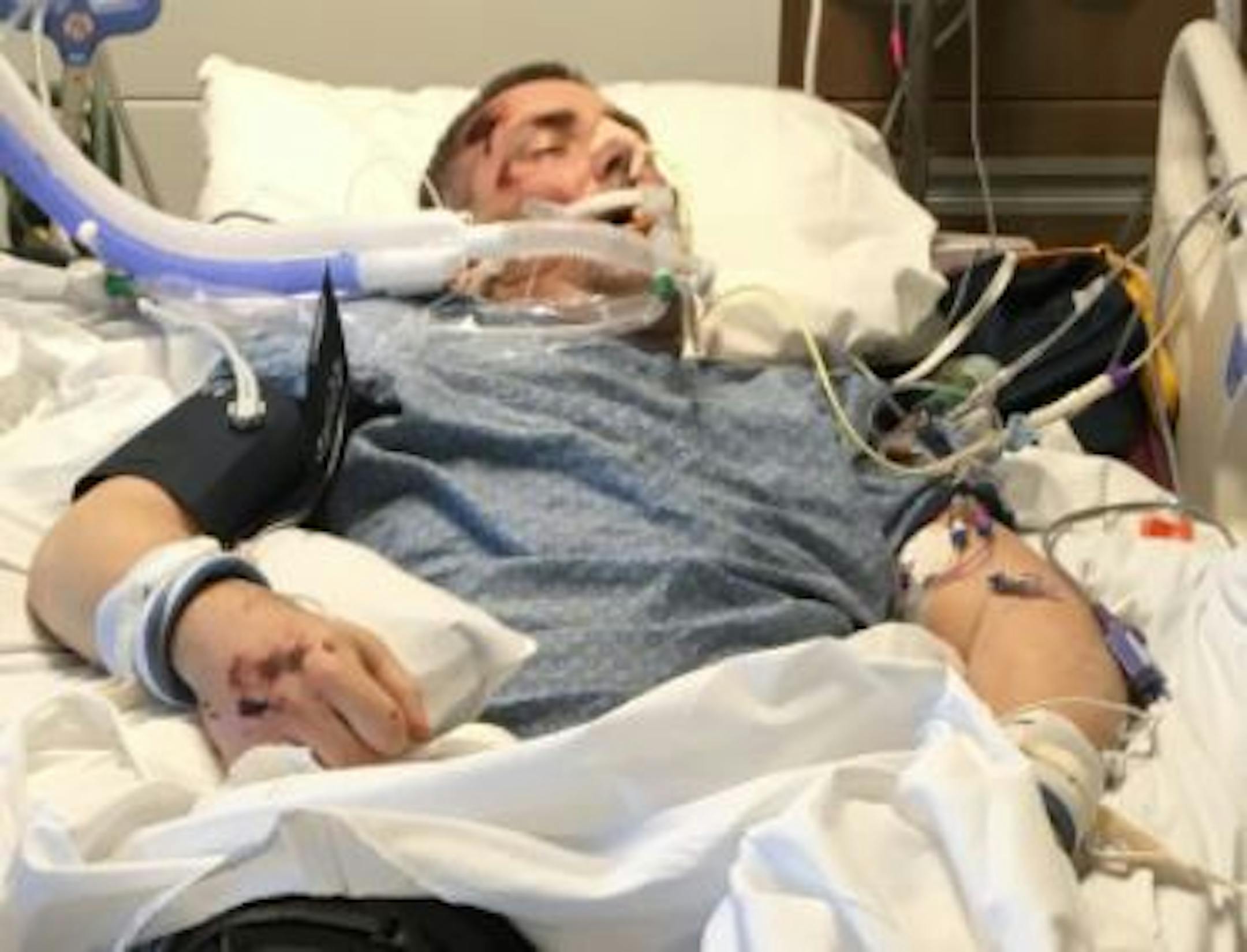 Casey Kearns, in Mercy Hospital in Coon Rapids.