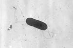 FILE - This 2002 electron microscope image made available by the Centers for Disease Control and Prevention shows a Listeria monocytogenes bacterium, 