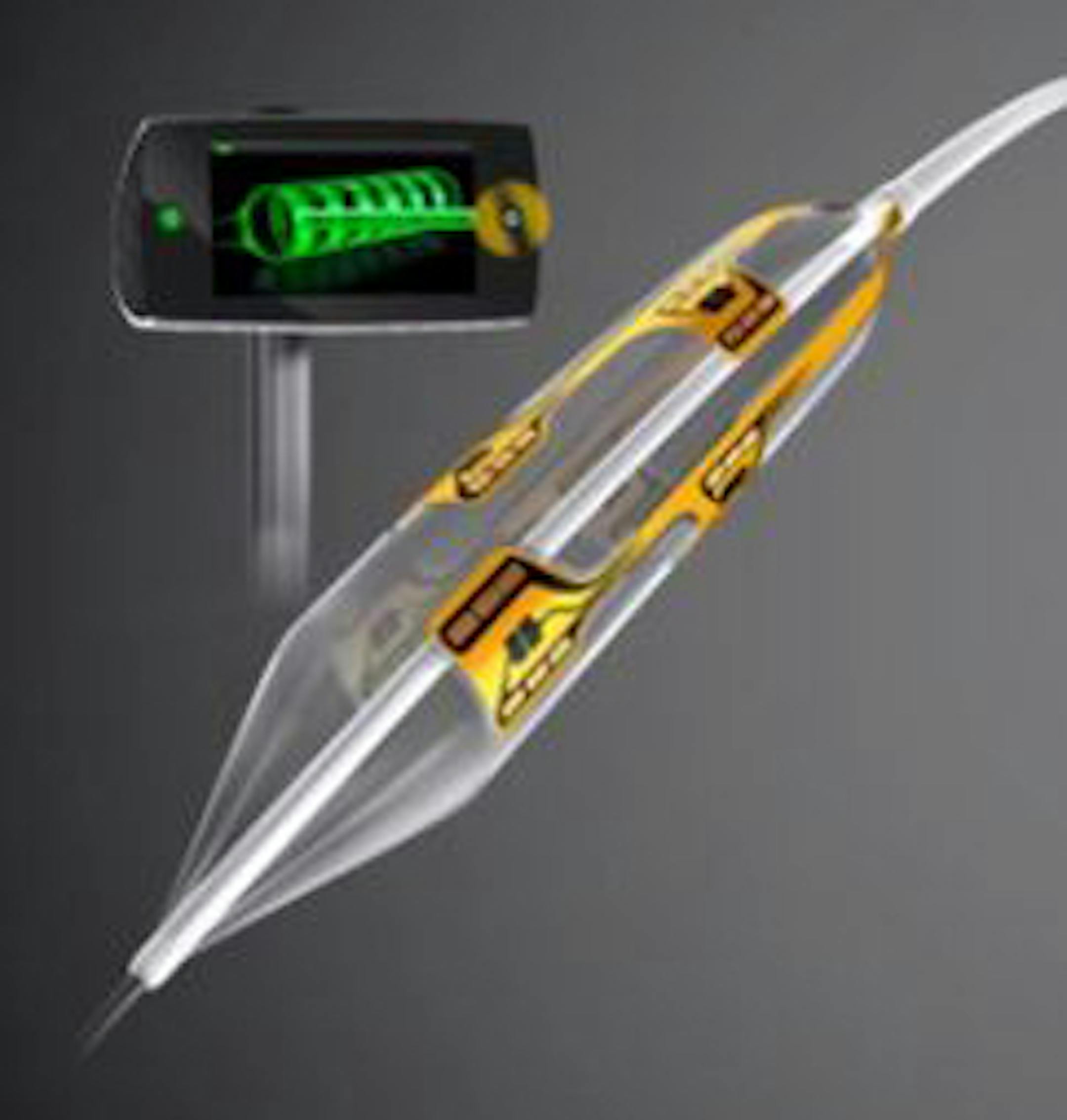 Vessix Renal Denervation System caption here bla bla bla