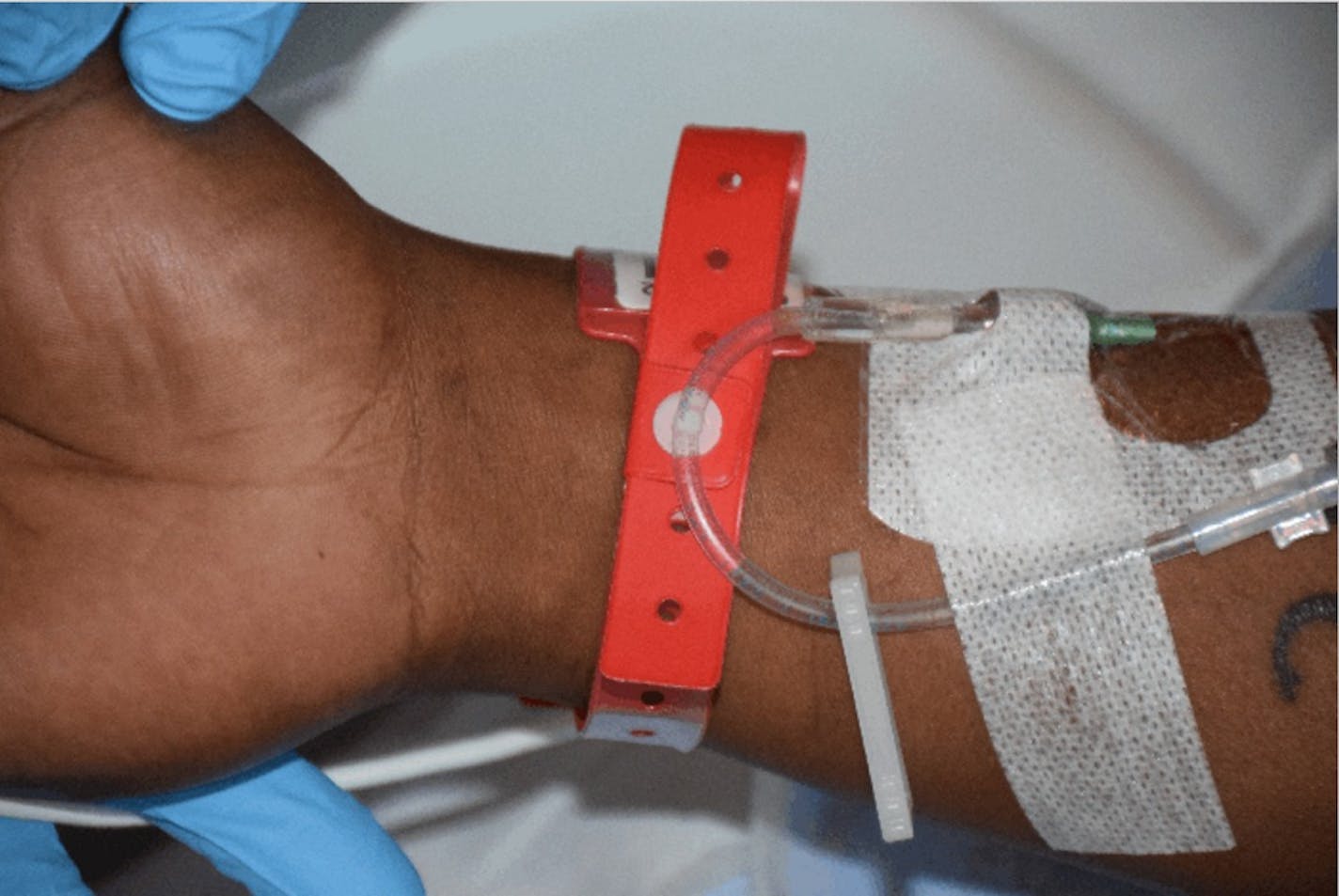 Jamar Clark's wrist is shown following the shooting.