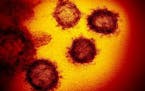 This transmission electron microscope image shows SARS-CoV-2, the virus that causes COVID-19, isolated from a patient in the U.S., emerging from the s