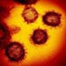 This transmission electron microscope image shows SARS-CoV-2, the virus that causes COVID-19, isolated from a patient in the U.S., emerging from the s