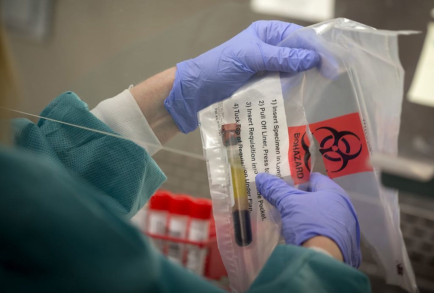 A medical laboratory technician for the Minnesota Health Department processes tubes with saliva from patients to test for measles in May 2017.