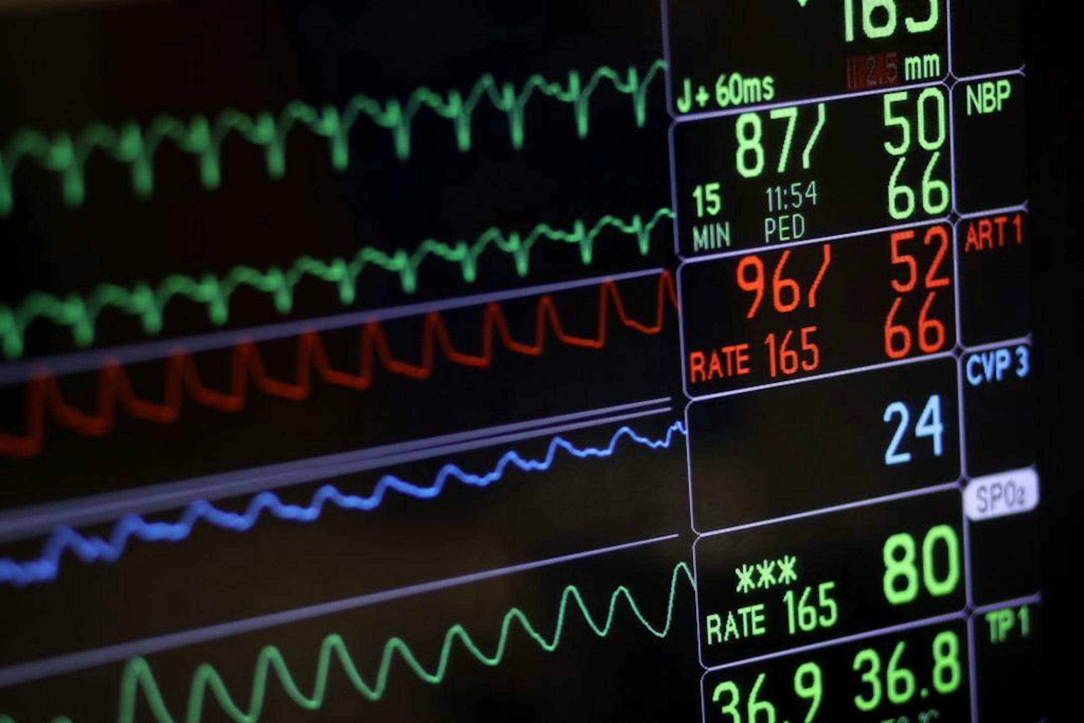 FILE- In this Nov. 28, 2016, file photo, a screen displays a patient's vital signs during open heart surgery at the University of Maryland Medical Center in Baltimore. U.S. hospitals are now required to post list prices for medical services online, under federal rules meant to help patients find affordable care and avoid hefty surprise bills.
