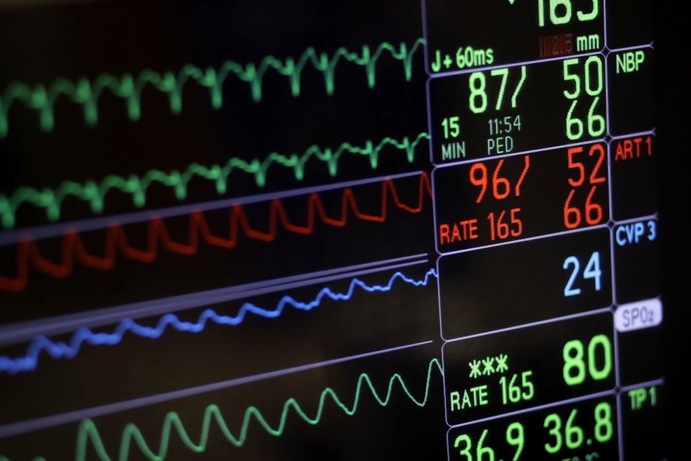 FILE- In this Nov. 28, 2016, file photo, a screen displays a patient's vital signs during open heart surgery at the University of Maryland Medical Center in Baltimore. U.S. hospitals are now required to post list prices for medical services online, under federal rules meant to help patients find affordable care and avoid hefty surprise bills.