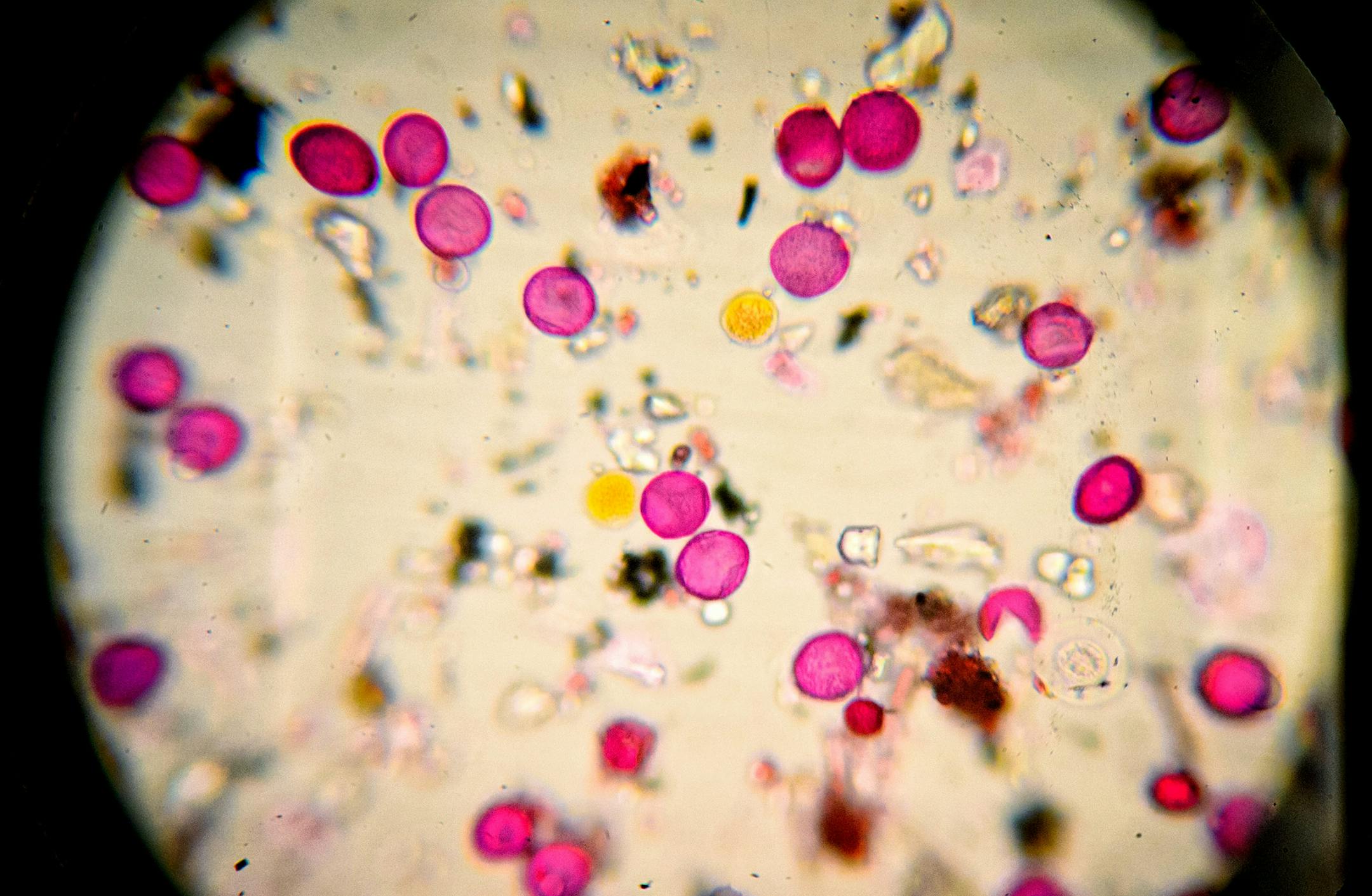 Pollen samples collected over the weekend by Krista Sullivan were mostly poplar and elm pollen. They were viewed under a microscope at the Clinical Research Institute. Pollen grains are dyed red to allow easier counting. ] Monday, April 28, 2014 GLEN STUBBE * gstubbe@startribune.com