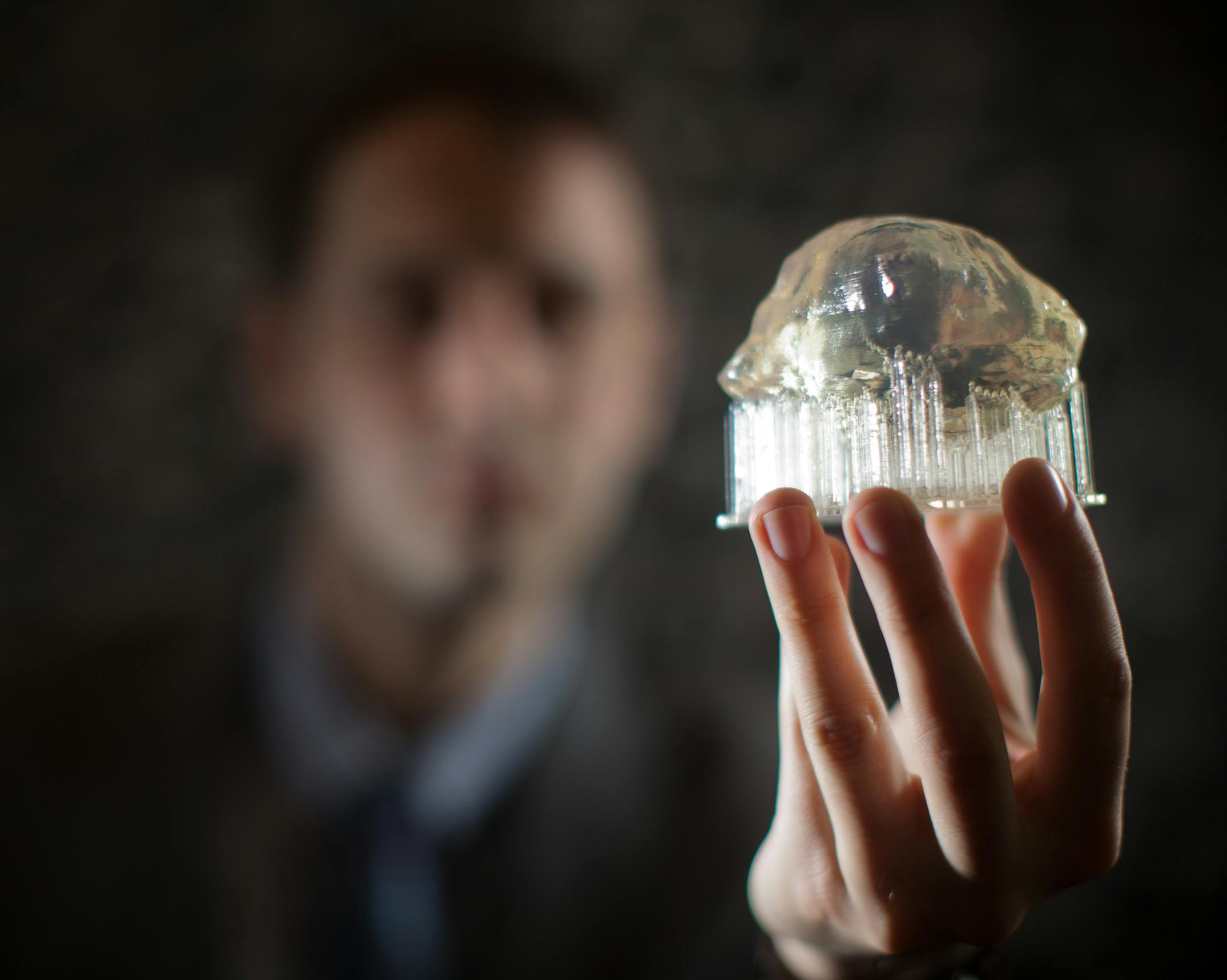 Steven Keating, a doctoral student at the Massachusetts Institute of Technology, holds a 3D-printed model of his cancerous astrocytoma brain tumor, in Cambridge, Mass., March 6, 2015. Keating’s case points to what medical experts say could be gained if patients had full and easier access to their own medical information. (Erik Jacobs/The New York Times)