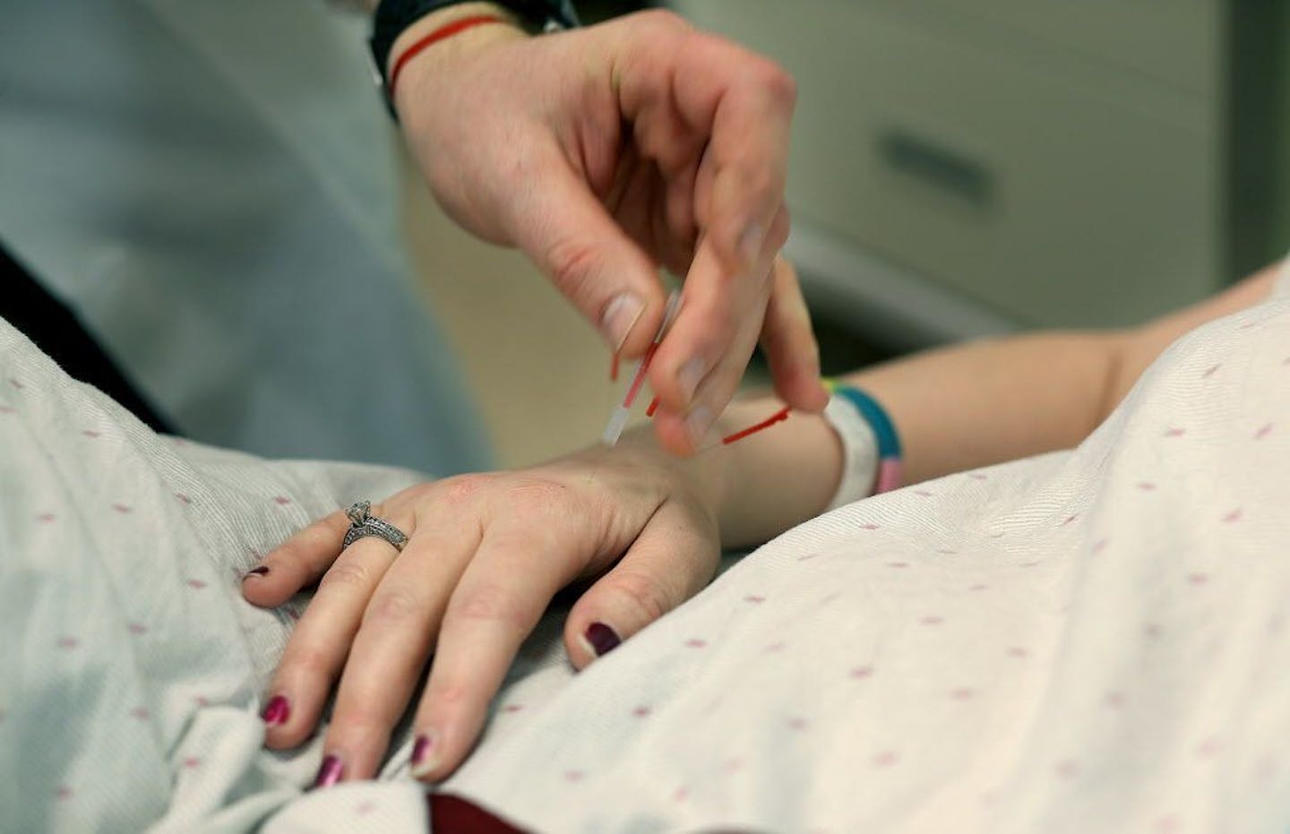 Acupuncture Specialist Adam Reinstein gave an acupuncture treatment to cancer patient Julie Valley at the Abbott Northwestern emergency room, Monday, March 7, 2016 in Minneapolis, MN.