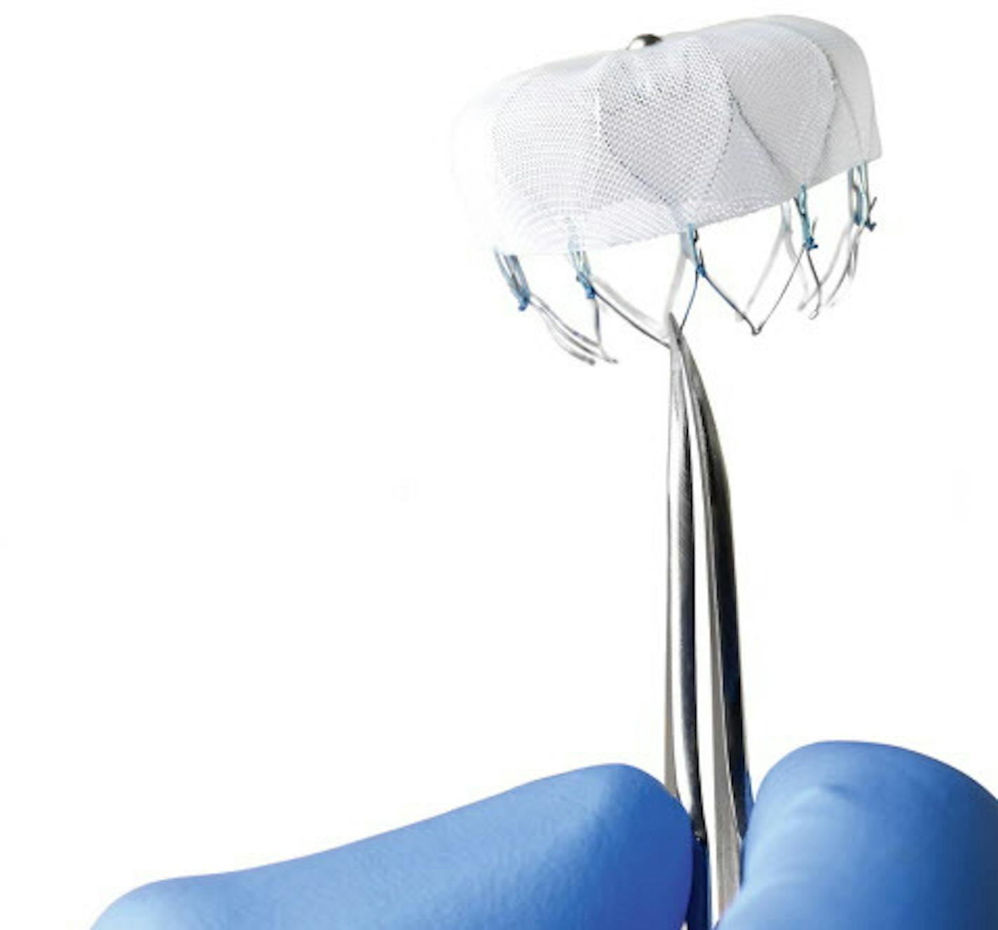 The Watchman Left Atrial Appendage Closure Device from Boston Scientific was developed in the Twin Cities by Aritech, which was bought by Boston. The device is deisgned to reduce stroke risk in patients with atrial fibrillation. It has recently been approved for use in US.