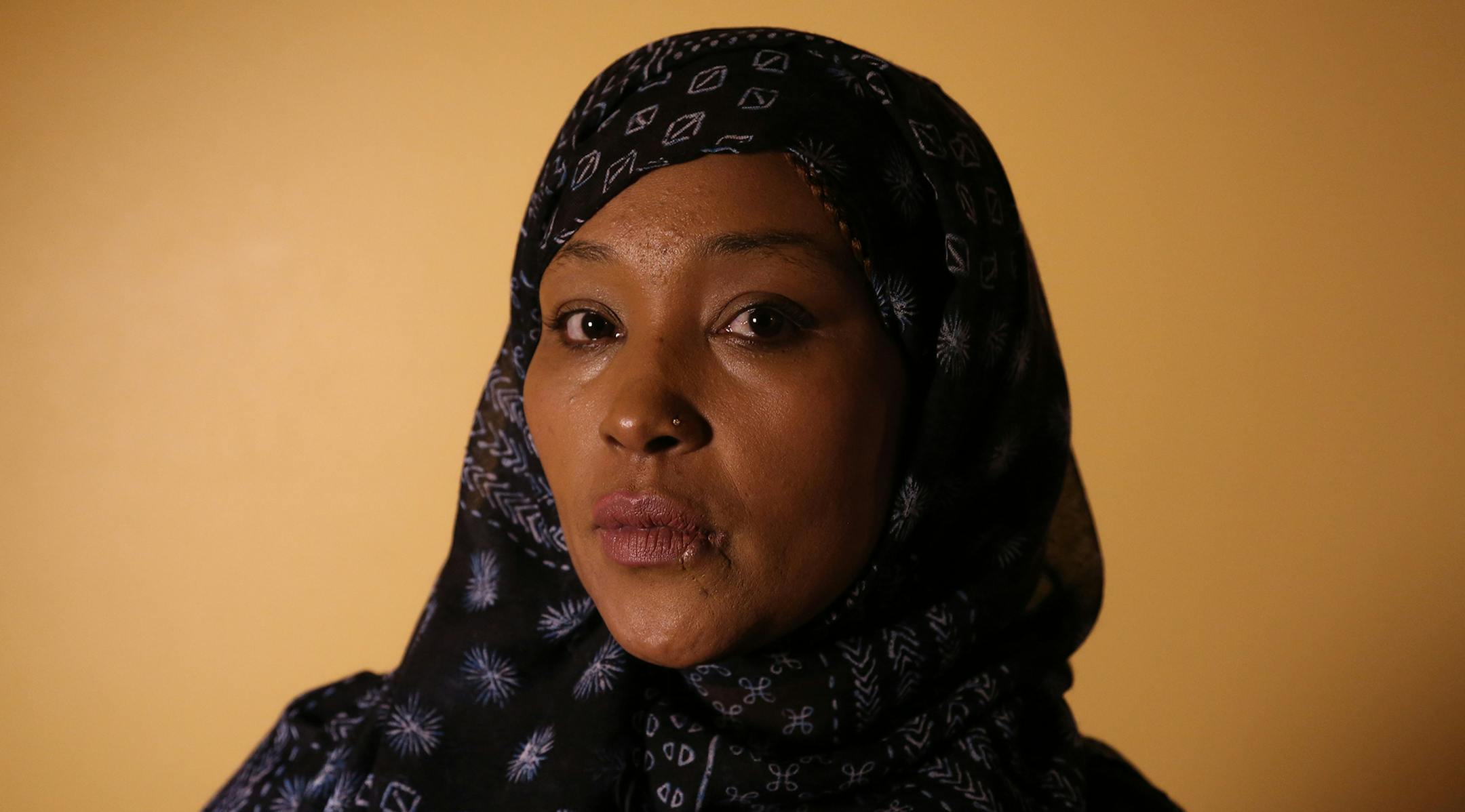 Asma Jama talked about how a woman smashed a beer mug in her face at the Coon Rapids Applebee's and how that moment has effected her life. ] (KYNDELL HARKNESS/STAR TRIBUNE) kyndell.harkness@startribune.com At a cousin's home in Coon Rapids Min., Wednesday November 25, 2015. ORG XMIT: MIN1511271226560973