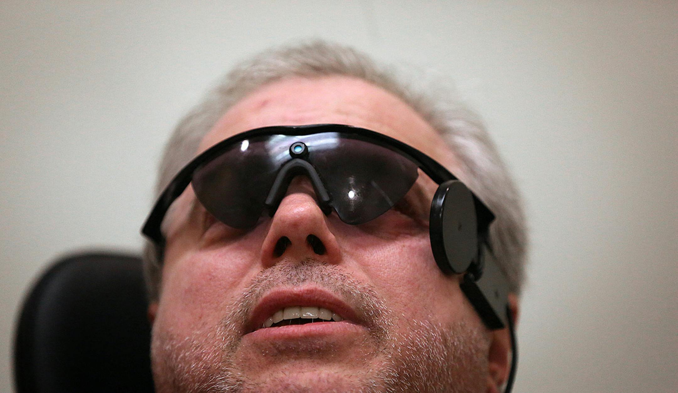 After decades of seeing nothing but a black canvas of charcoal gray, Duluth pastor James Kelm received a bionic eye implant that will allow him to identify shapes and contrast objects in front of him. On Friday, two weeks after the bionic implant surgery, the implant was activated at the U of M Medical Center. This is the second such implant in Minnesota and one of only about 100 so far in the U.S. to treat a form of blindness known as retinitis pigmentosa. Wearing a special set of glasses which