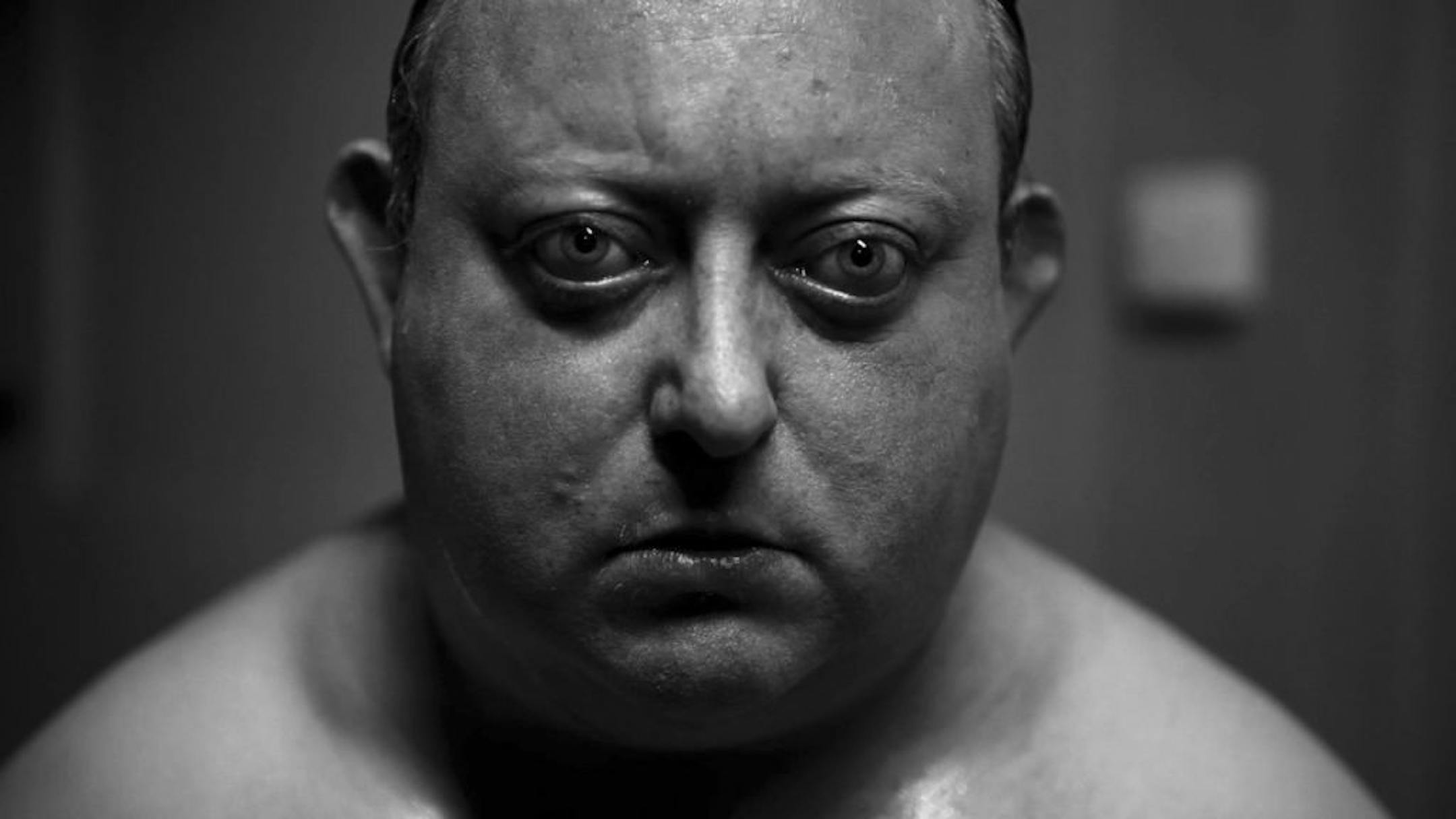 Laurence Harvey in "The Human Centipede"
