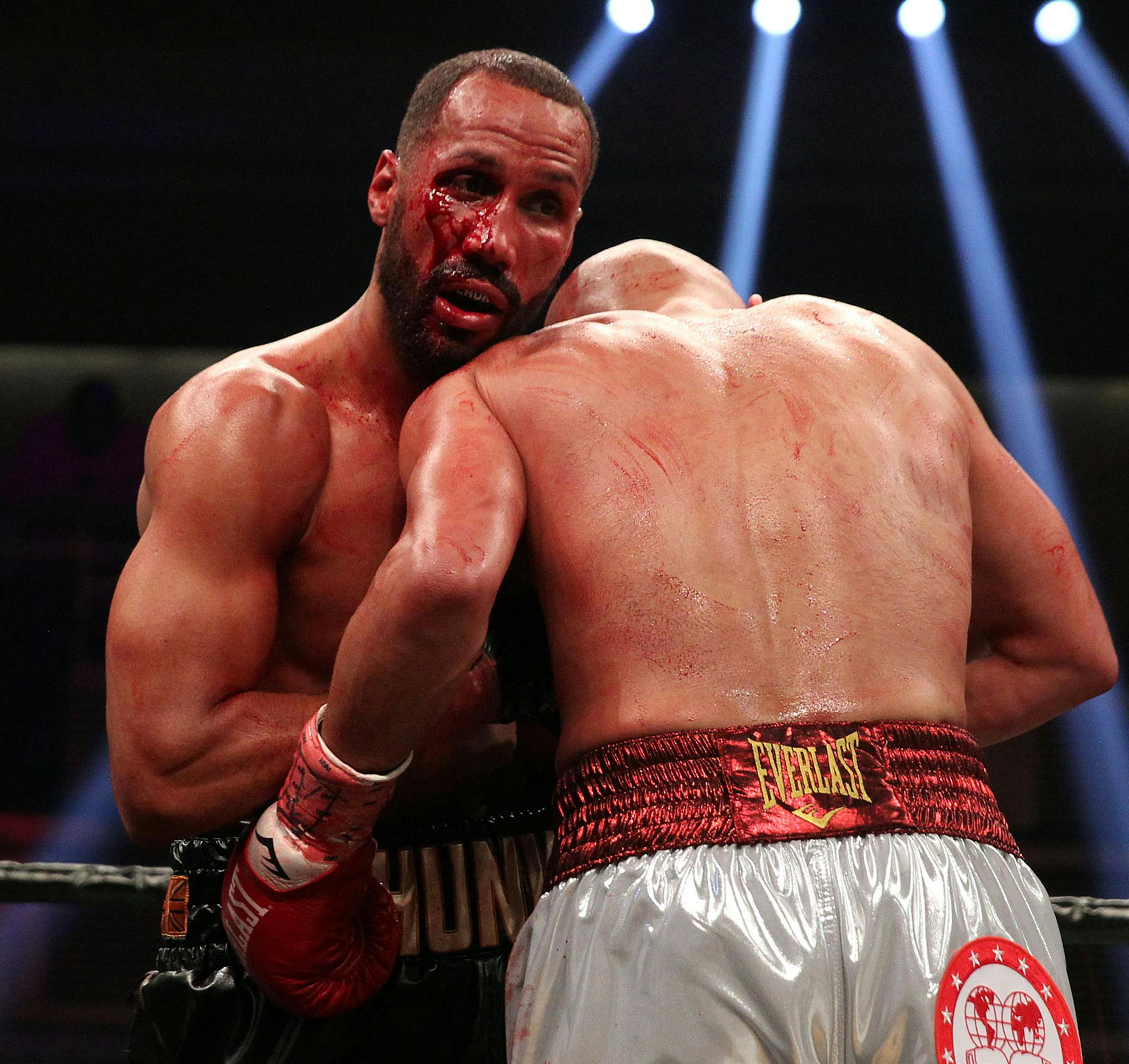 Caleb Truax, back to camera, bloodied James DeGale but lost a unanimous decision in an IBF super middleweight championship fight Saturday, April 7, 2018 at the Hard Rock Hotel in Las Vegas. Truax lost the championship he had taken from DeGale in an earlier fight.
Mayweather Promotions/Chris Farina