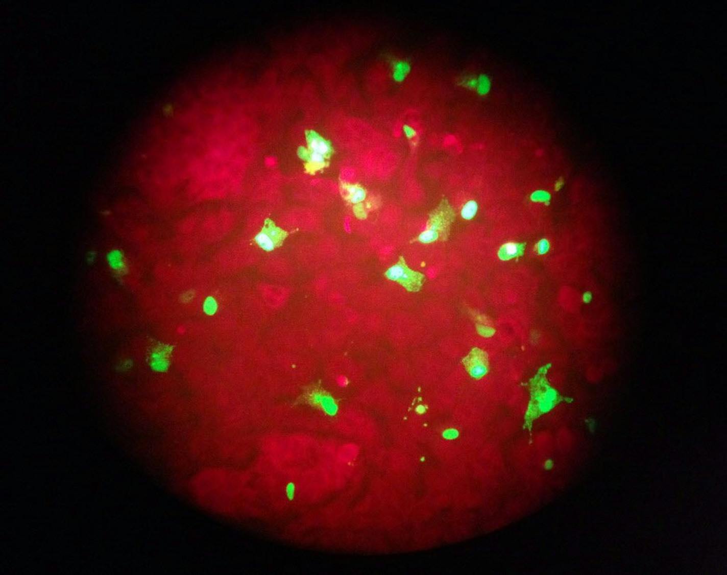 FILE - In this Feb. 26, 2015 photo taken through the eyepiece of a microscope, human cells infected with the flu virus glow green under light from a fluorescence microscope at a laboratory in Seattle. The U.S. government estimates that 80,000 Americans died of flu and flu complications in the winter of 2017-2018 - the highest flu-related death toll in at least four decades.