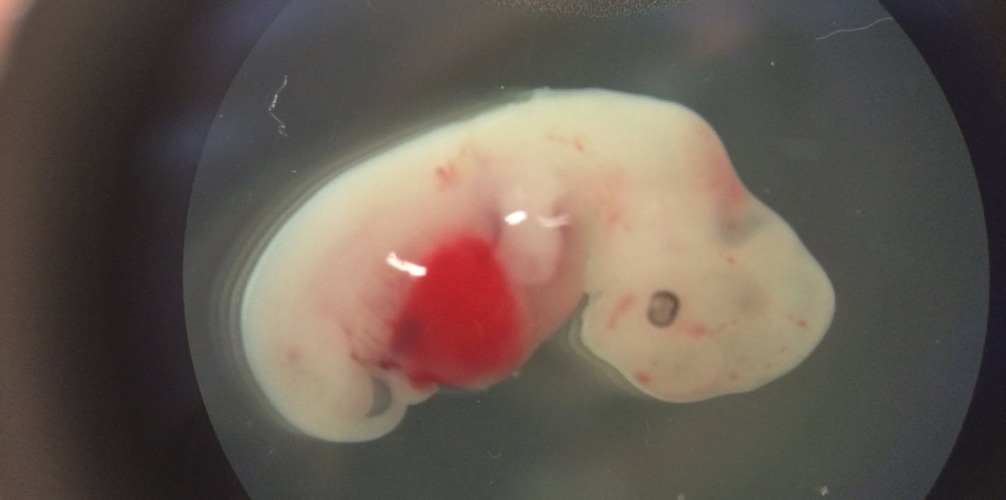 This undated photo provided by the Salk Institute on Jan. 24, 2017 shows a 4-week-old pig embryo which had been injected with human stem cells. The experiment was a very early step toward the possibility of growing human organs inside animals for transplantation. (Salk Institute via AP)