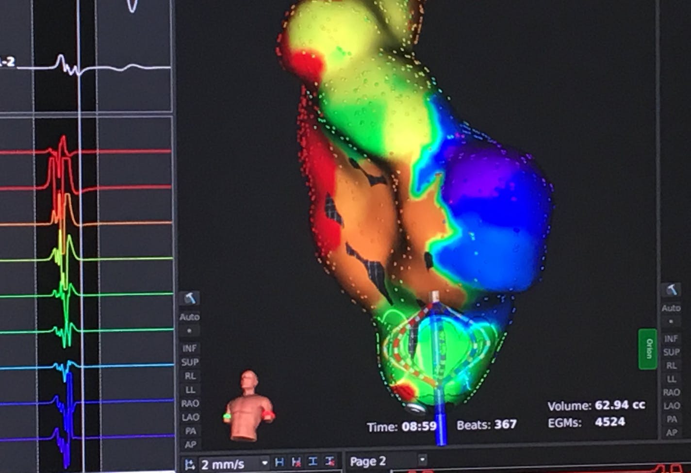 Rhythmia by Boston Scientific