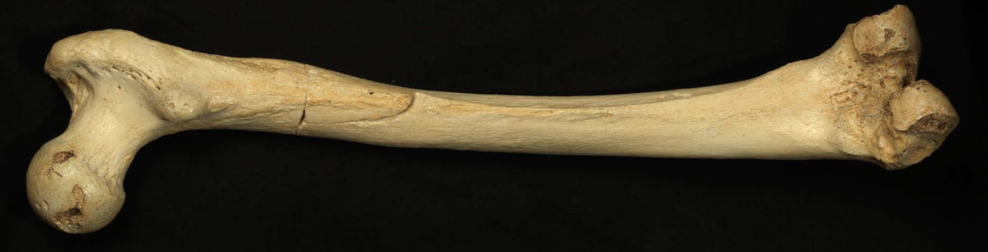 This undated photo provided by Madrid Scientific Films in December 2013 shows the thigh bone of a hominin estimated to be about 400,000-years-old, excavated from Sima de los Huesos, Spain. Scientists have reached farther back than ever into the ancestry of humans to recover and analyze DNA, with a sample from this bone. So far, the achievement has provided more questions than answers about the human family tree. Results were presented online Wednesday, Dec. 4, 2013 in the journal Nature by Matth